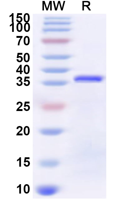 Recombinant Human ZNF774 Protein, N-His