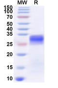 Recombinant Human ZFP1 Protein, N-His