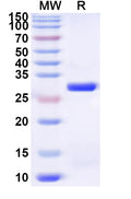 Recombinant Human MYORG Protein, N-His