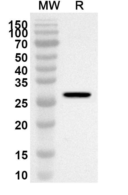 Western blot analysis was performed using anti-MYORG polyclonal antibody at 1ug/mL on recombinant MYORG (Catalog No. HB369012).