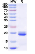 Recombinant Human TOM1L2 Protein, N-His