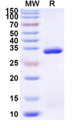 Recombinant Human TRMT10B Protein, N-His