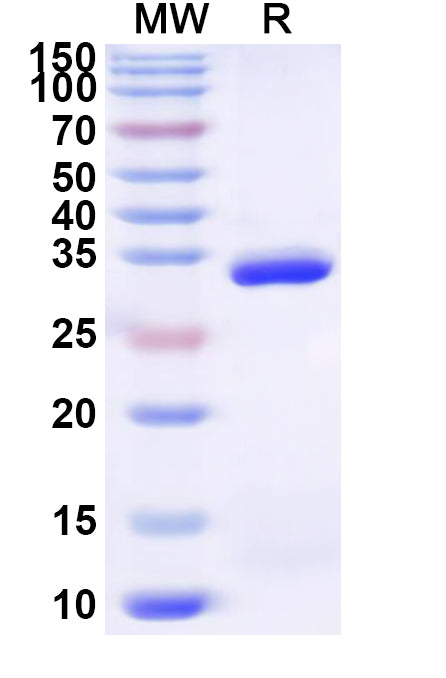 Recombinant Human TRMT10B Protein, N-His