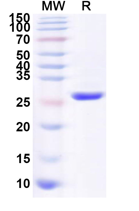 Recombinant Human COPS5 Protein, N-His