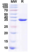 Recombinant Human DTX2 Protein, N-His