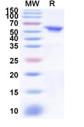 Recombinant Human ITK Protein, N-His
