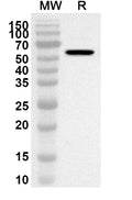 Western blot analysis was performed using anti-ITK polyclonal antibody at 1ug/mL on recombinant ITK (Catalog No. HB378012).