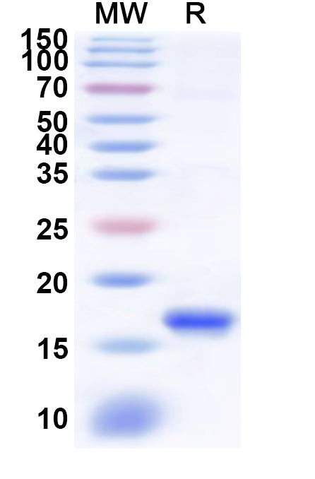 Recombinant Human KLRC3 Protein, N-His