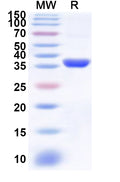 Recombinant Human CRYZ Protein, N-His