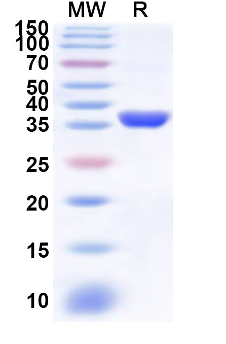 Recombinant Human CRYZ Protein, N-His