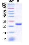 Recombinant Human RING1 Protein, N-His