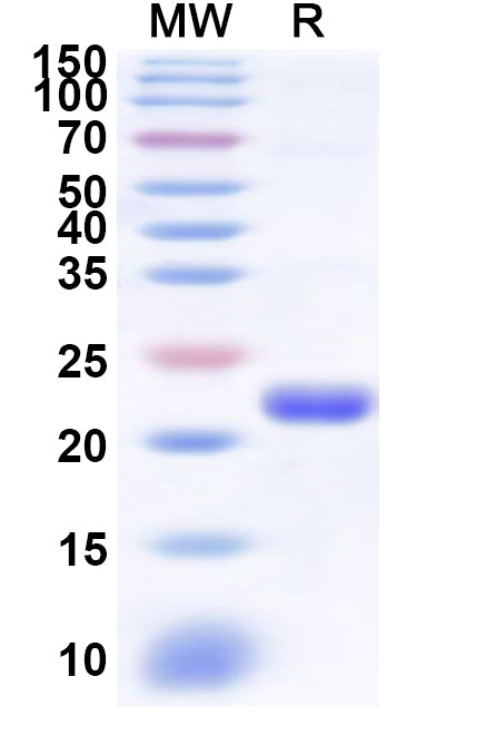 Recombinant Human RING1 Protein, N-His