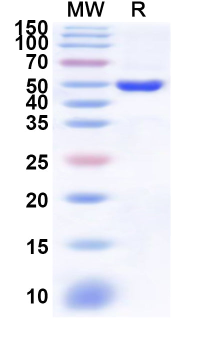 Recombinant Human PMPCA Protein, N-His