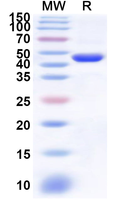 Recombinant Human GALNT2 Protein, N-His