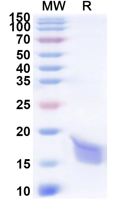 Recombinant Human LAMTOR4 Protein, N-His