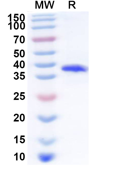 Recombinant Human ZNF460 Protein, N-His
