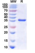 Recombinant Human ST3GAL3 Protein, N-His