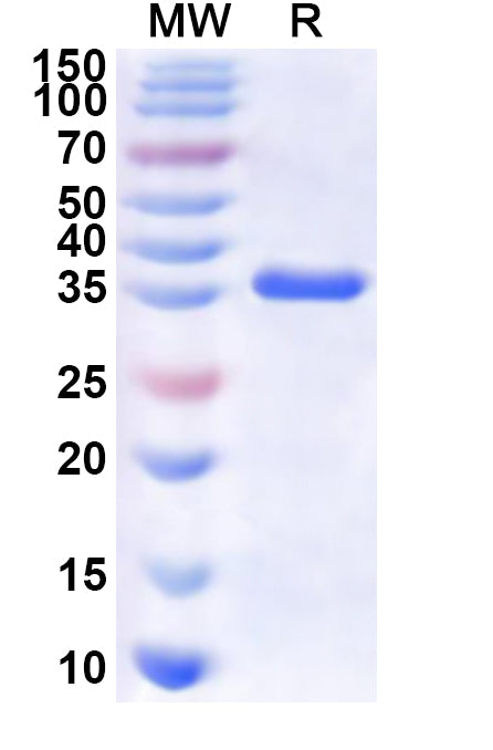 Recombinant Human ST3GAL3 Protein, N-His