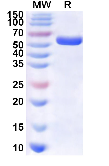 Recombinant Human SF3A3 Protein, N-His