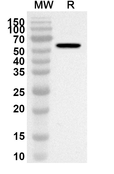 Western blot analysis was performed using anti-SF3A3 polyclonal antibody at 1ug/mL on recombinant SF3A3 (Catalog No. HB387012).
