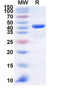 Recombinant Human CLPSL1 Protein, N-GST & C-His
