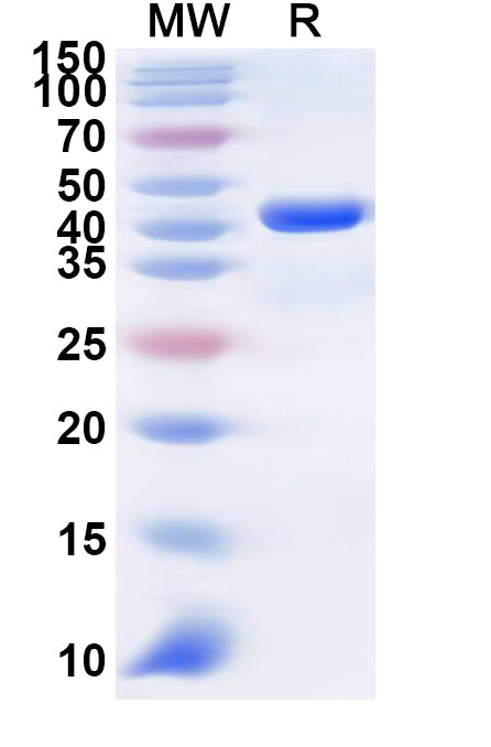 Recombinant Human CLPSL1 Protein, N-GST & C-His