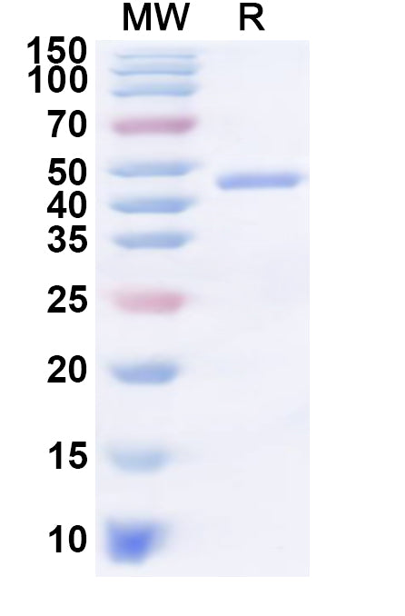 Recombinant Human SMYD5 Protein, N-His