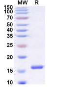 Recombinant Human ZFYVE16 Protein, N-His