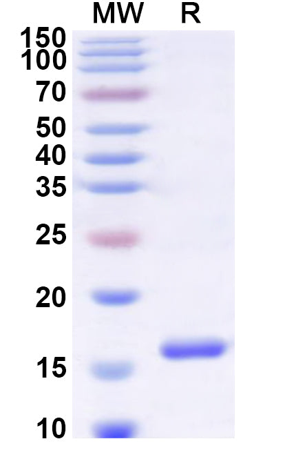 Recombinant Human ZFYVE16 Protein, N-His