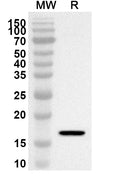 Western blot analysis was performed using anti-ZFYVE16 polyclonal antibody at 1ug/mL on recombinant ZFYVE16 (Catalog No. HB390012).