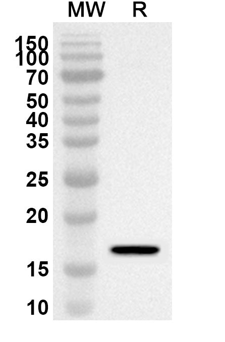 Western blot analysis was performed using anti-ZFYVE16 polyclonal antibody at 1ug/mL on recombinant ZFYVE16 (Catalog No. HB390012).