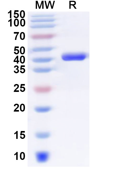 Recombinant Human PTER Protein, N-His