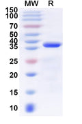 Recombinant Human RANGAP1 Protein, N-His