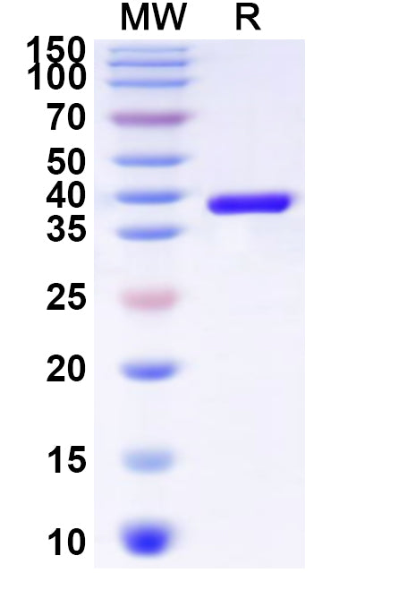 Recombinant Human YAF2 Protein, N-His-KSI