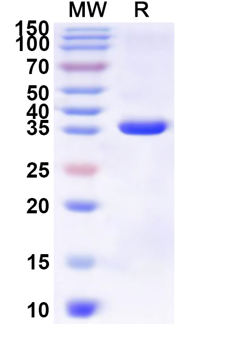 Recombinant Human CD3G Protein, N-GST & C-His