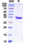 Recombinant Human SLC16A4 Protein, N-His-KSI