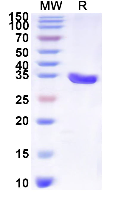 Recombinant Human SLC16A4 Protein, N-His-KSI