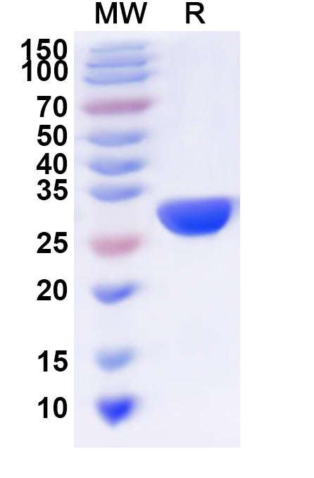 Recombinant Human SPR Protein, N-His