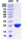 Recombinant Human RAB5C Protein, N-His