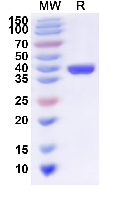 Recombinant Human GCC1 Protein, N-His