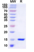 Recombinant Human DAZAP2 Protein, N-His
