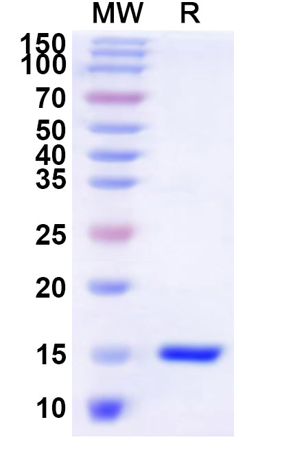 Recombinant Human DAZAP2 Protein, N-His