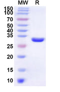 Recombinant Human LBH Protein, N-His-KSI