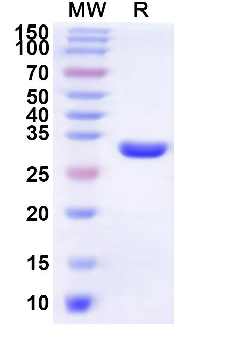 Recombinant Human LBH Protein, N-His-KSI