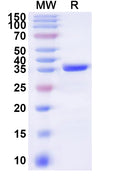 Recombinant Human ODF1 Protein, N-GST & C-His