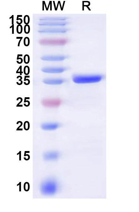 Recombinant Human ODF1 Protein, N-GST & C-His