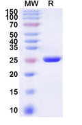 Recombinant Human SLC13A3 Protein, N-His-KSI