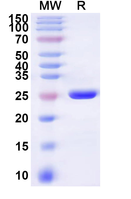 Recombinant Human SLC13A3 Protein, N-His-KSI