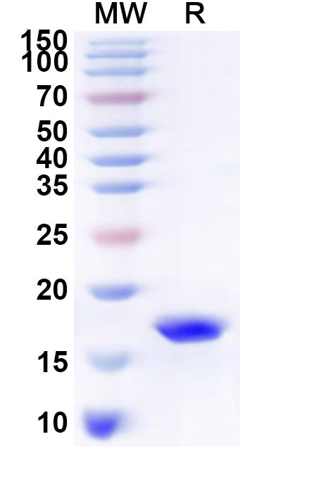 Recombinant Human C1D Protein, N-His