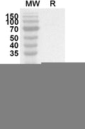 Western blot analysis was performed using anti-C1D polyclonal antibody at 1ug/mL on recombinant C1D (Catalog No. HB407012).
